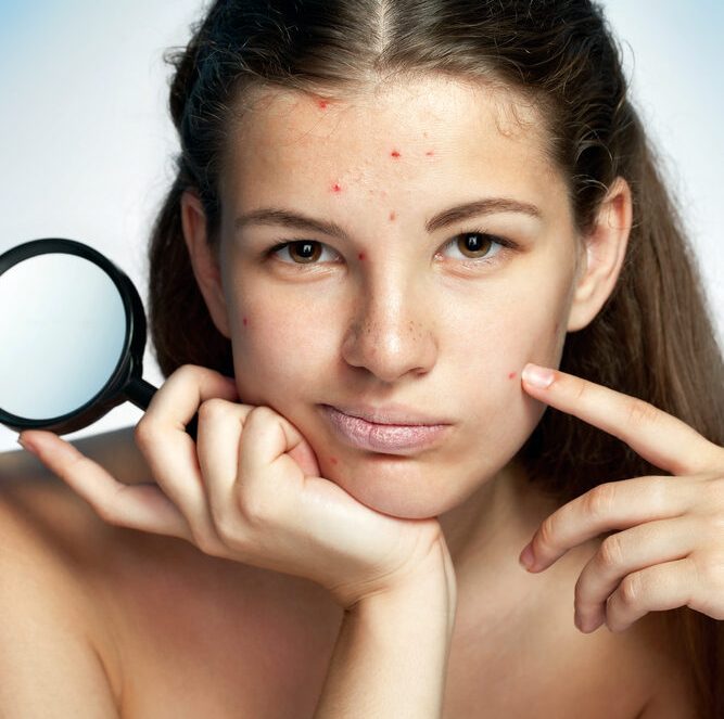 Detox acne treatment